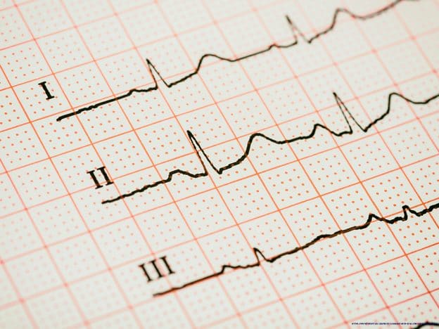 Congestive Heart Failure for EMT course image